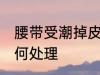 腰带受潮掉皮怎么办 腰带受潮掉皮如何处理